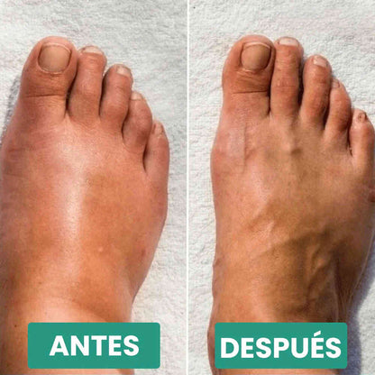 Masajeador de pies Easefeet™ + Guía para tu bienestar 🎁