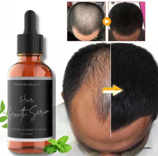 Hair grouth serum