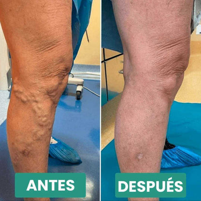 Masajeador de pies Easefeet™ + Guía para tu bienestar 🎁
